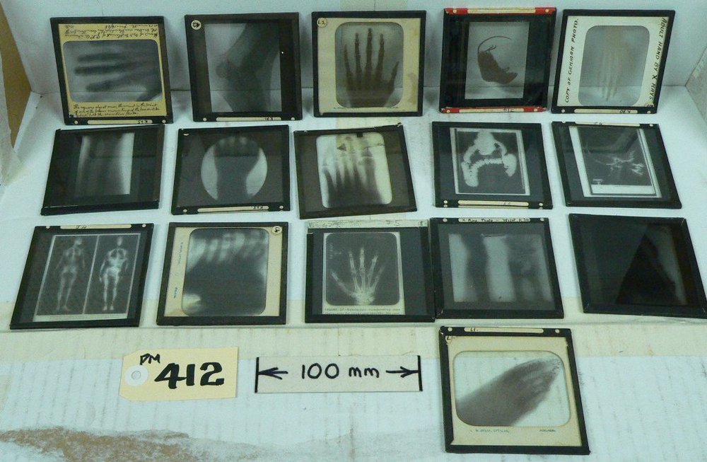 X-Ray Glass Negatives
