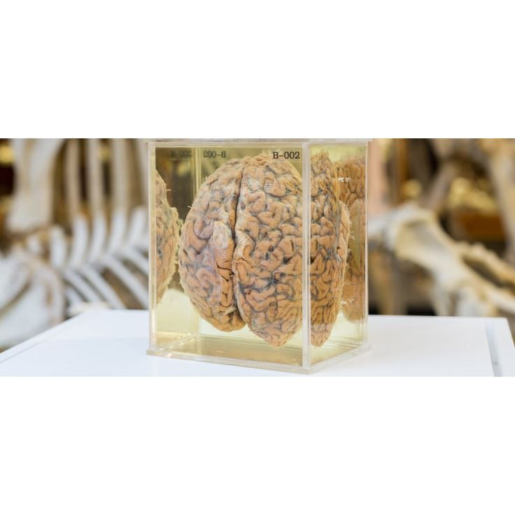 The Brain of Ullin T Place 