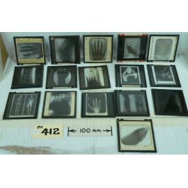 X-Ray Glass Negatives