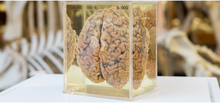 The Brain of Ullin T Place 